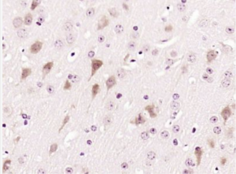 Anti-CD155 antibody-脊髓灰质炎病毒受体抗体