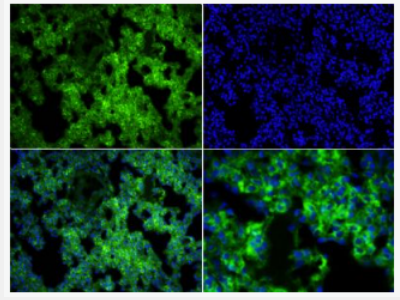 Anti-MARCO antibody-巨噬细胞清道夫受体抗体