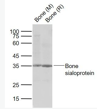 Anti-Bone sialoprotein antibody-骨涎蛋白抗体