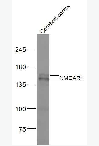 Anti-NMDAR1 antibody-谷氨酸受体1抗体