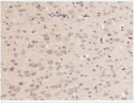 Anti-ACHE antibody-乙酰胆碱酯酶抗体