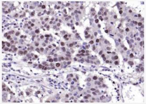 Anti-Claudin 4 antibody-紧密连接蛋白4抗体