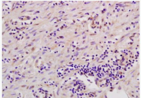 Anti-MSK1 antibody-有丝分裂原和应激活化型蛋白激酶1抗体