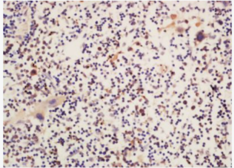 Anti-Phospho-Btk (Ser180) antibody-磷酸化酪氨酸蛋白激酶BTK抗体