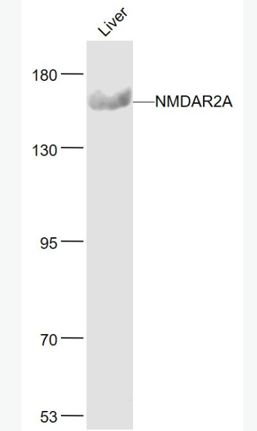 Anti-NMDAR2A antibody-谷氨酸受体2A抗体