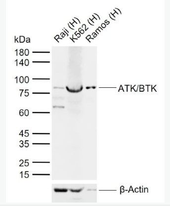 Anti-ATK/BTK antibody-酪氨酸蛋白激酶BTK抗体