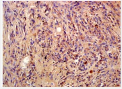 Anti-Phospho-BLNK (Tyr96) antibody-磷酸化T淋巴细胞连接蛋白抗体