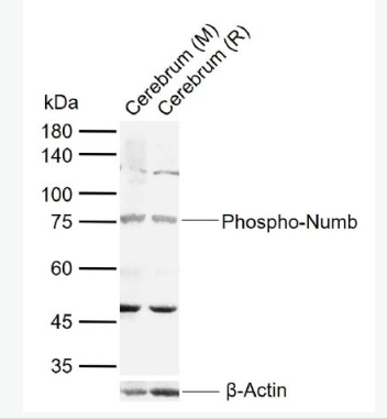 Anti-Phospho-Numb (Ser276) antibody-磷酸化膜相关蛋白Numb抗体