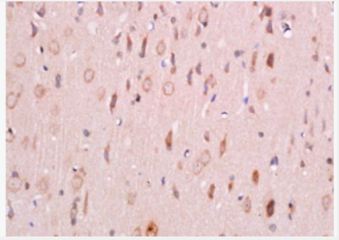 Anti-Phospho-PDK1 (Ser241) antibody-磷酸化3磷酸肌醇依赖性蛋白激酶1