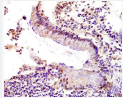 Anti-p53BP1 antibody-p53结合蛋白1抗体