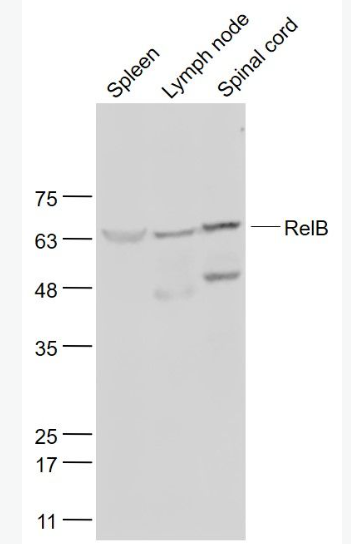 Anti-RelB antibody-核转录因子NFKB-RelB蛋白抗体