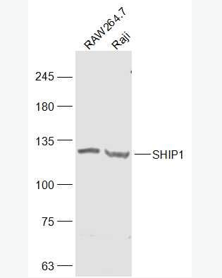 Anti-SHIP1 antibody-SH2结构含磷酸肌醇SHIP1抗体