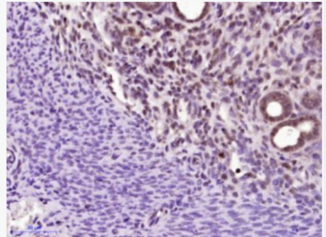 Anti-CPSF4 antibody-剪切和多聚腺苷酸化特异性因子4抗体