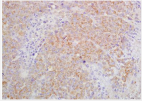 Anti-IL27R antibody-白细胞介素27受体抗体