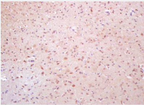 Anti-Phospho-TAK1 (Thr184) antibody-磷酸化转化生长因子β活化激酶1