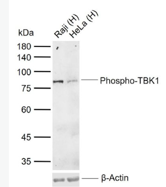 Anti-Phospho-TBK1 (Ser172) antibody-磷酸化NF-κB活化激酶抗体