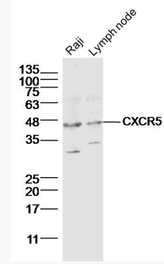 Anti-CXCR5 antibody-细胞表面趋化因子受体5（CD185）抗体