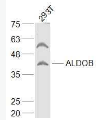 Anti-ALDOB antibody-醛缩酶2抗体