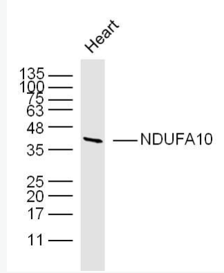 Anti-NDUFA10 antibody-NADH氧化还原酶辅酶10抗体