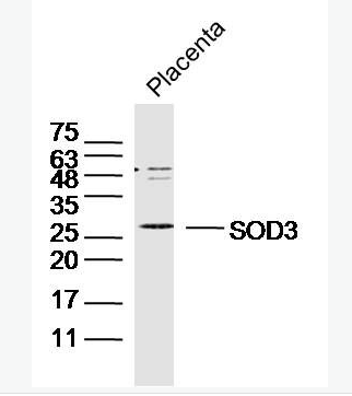 Anti-SOD3 antibody-超氧化物歧化酶3抗体