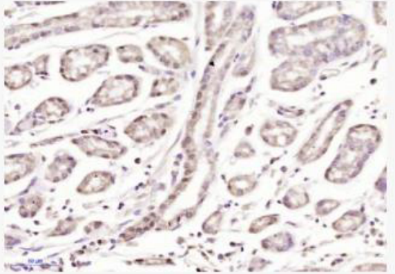 Anti-AMBRA1 antibody-自噬相关基因AMBRA1抗体