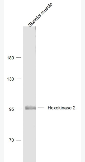 Anti-Hexokinase 2  antibody-己糖激酶2抗体