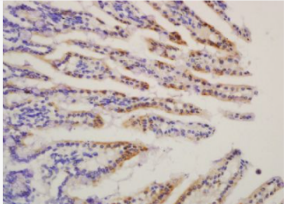 Anti-HMGCS2 antibody-三羟基三甲基辅酶A合成酶2抗体