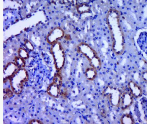 Anti-PDHB antibody-丙酮酸脱氢酶E1β亚单位抗体