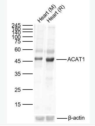 Anti-ACAT1 antibody-乙酰辅酶A酰基转移酶1抗体