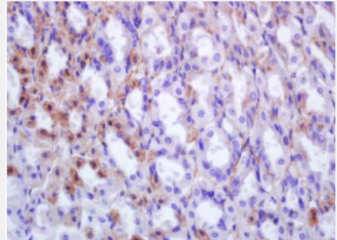 Anti-EPX antibody-嗜酸性粒细胞过氧化物酶抗体