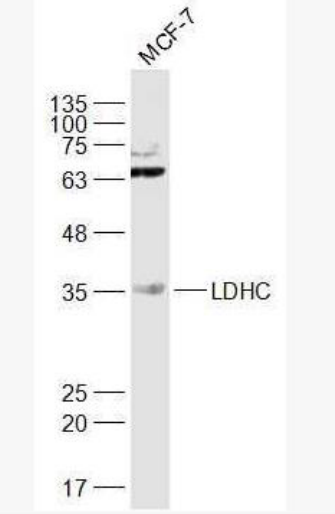 Anti-LDHC antibody-乳酸脱氢酶LDH-C/肿瘤/睾丸抗原32抗体