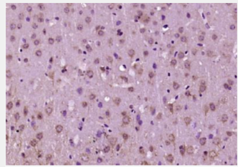 Anti-CYP46 antibody-胆固醇24S－羟化酶