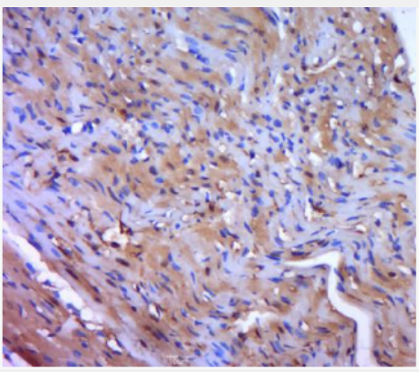 Anti-MYL9 antibody-肌球蛋白调节多肽9(平滑肌亚型)抗体