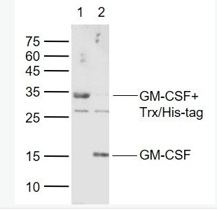 Anti-GM-CSF  antibody-粒细胞-巨噬细胞克隆刺激因子抗体