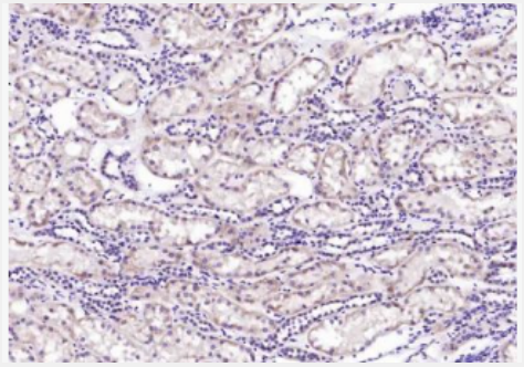 Anti-WNT10B antibody-信号通路WNT10B抗体