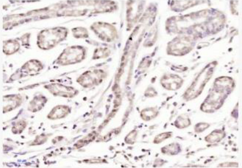 Anti-Phospho-PKC gamma (Thr514) antibody-磷酸化蛋白激酶C亚型G抗体