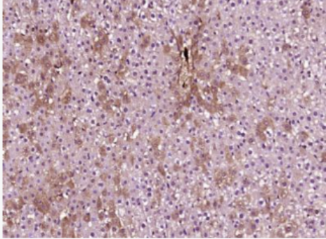 Anti-ME1 antibody-胞浆苹果酸酶1抗体