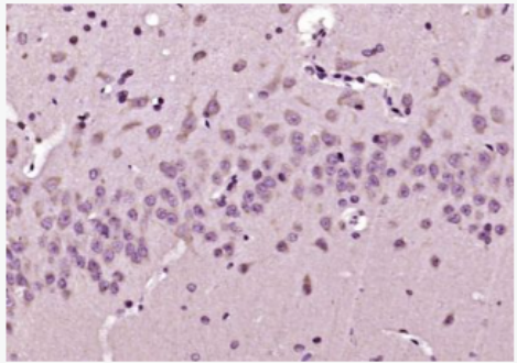 Anti-ERp29 antibody-内质网蛋白29抗体