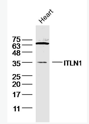 Anti-ITLN1 antibody-内皮细胞凝集素HL1抗体