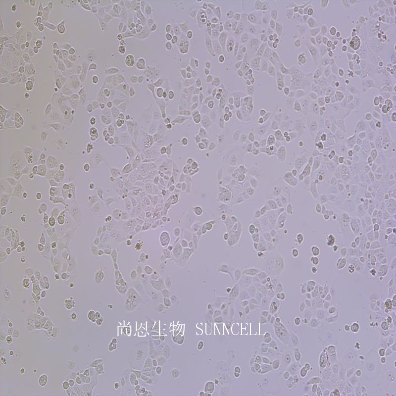 人子宫内膜腺癌细胞
