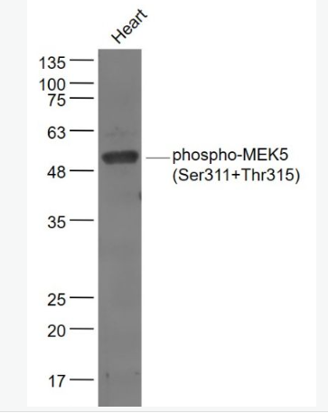 Anti-phospho-MEK5 (Ser311+Thr315) antibody-磷酸化丝裂原活化蛋白激酶激酶5抗体