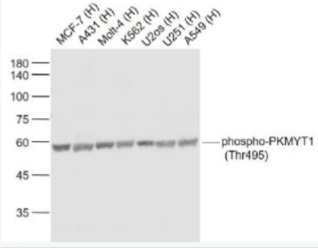 Anti-phospho-PKMYT1 (Thr495) antibody-磷酸化蛋白激酶PKMYT1(Thr495)抗体