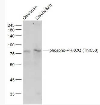 Anti-phospho-PRKCQ (Thr538) antibody-磷酸化蛋白激酶C theta抗体