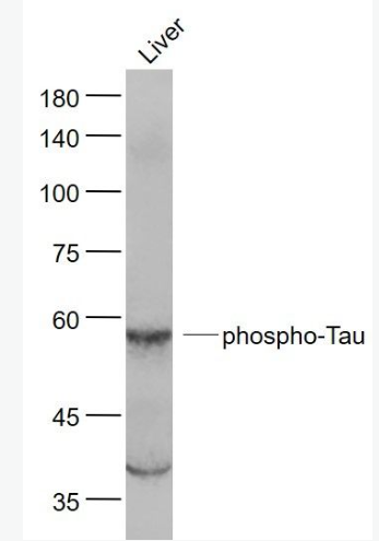 Anti-phospho-Tau (Ser214)  antibody-磷酸化微管相关蛋白抗体