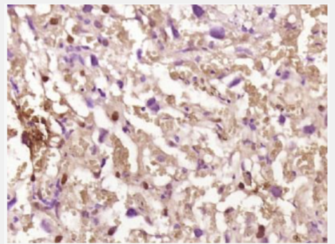 Anti-phospho-IKK beta (Ser471) antibody-磷酸化KB抑制蛋白激酶β抗体