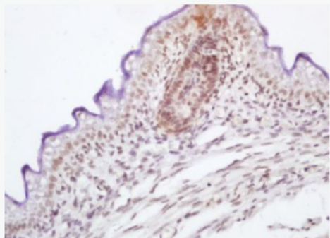 Anti-phospho-RAF1 (Ser339) antibody-磷酸化原癌基因RAF1抗体