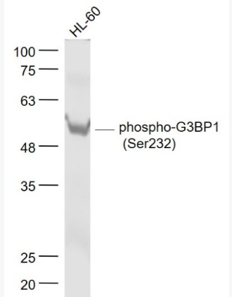 Anti-phospho-G3BP1 (Ser232) antibody-磷酸化Ras GTP酶活化蛋白结合蛋白1抗体