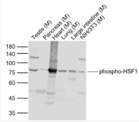 Anti-phospho-HSF1 (Ser307) antibody-磷酸化热休克因子1抗体