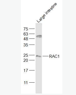 Anti-RAC1 antibody-细胞迁移诱导因子5抗体