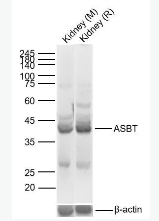 Anti-SLC10A2 antibody-顶膜钠依赖性胆盐转运体蛋白抗体